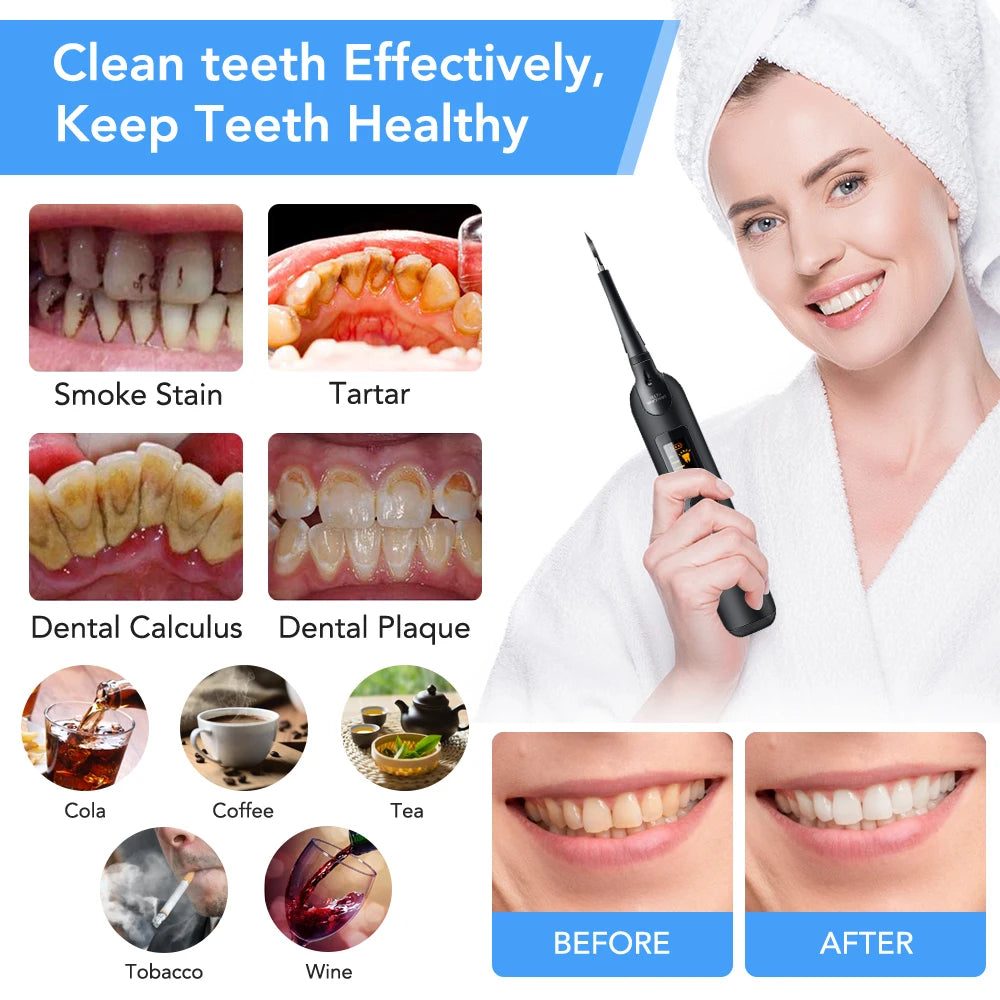 Ensemble de brosse dents électrique à LED avec détartreur sonique, élimine les taches et le tartre dentaire, nettoie les dents, blanchit les dents, hydrate et soigne les dents.